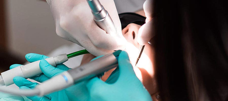 Prestazioni chirurgia dentaria studio GD Studio Dentistico Gussago dr. Delorenzi